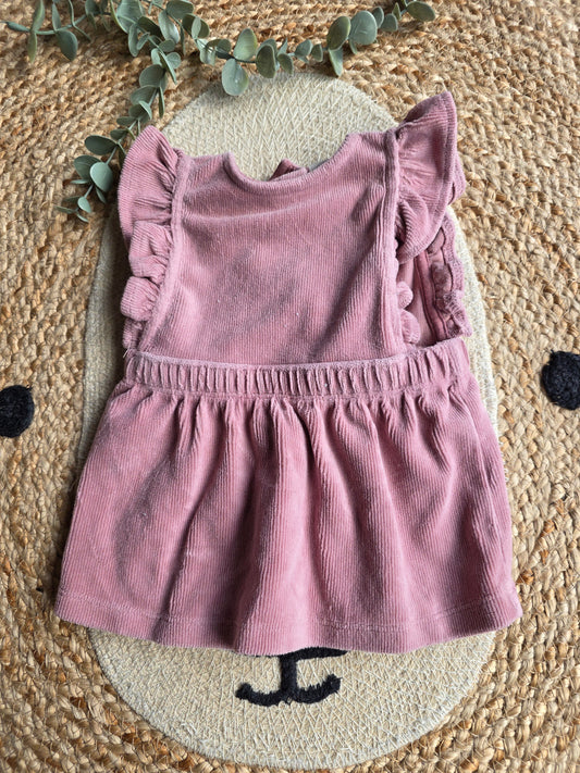 Prénatal overgooier maat 62